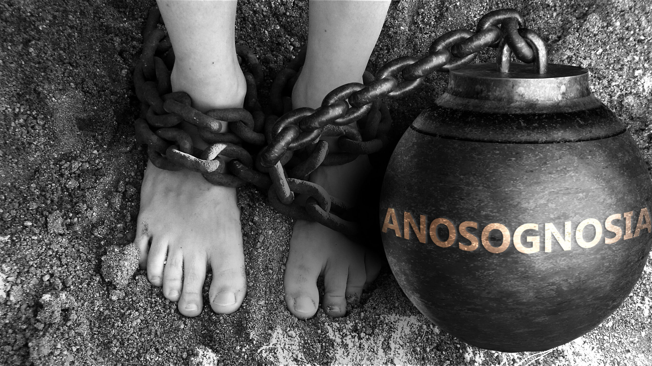 Anosognosia
